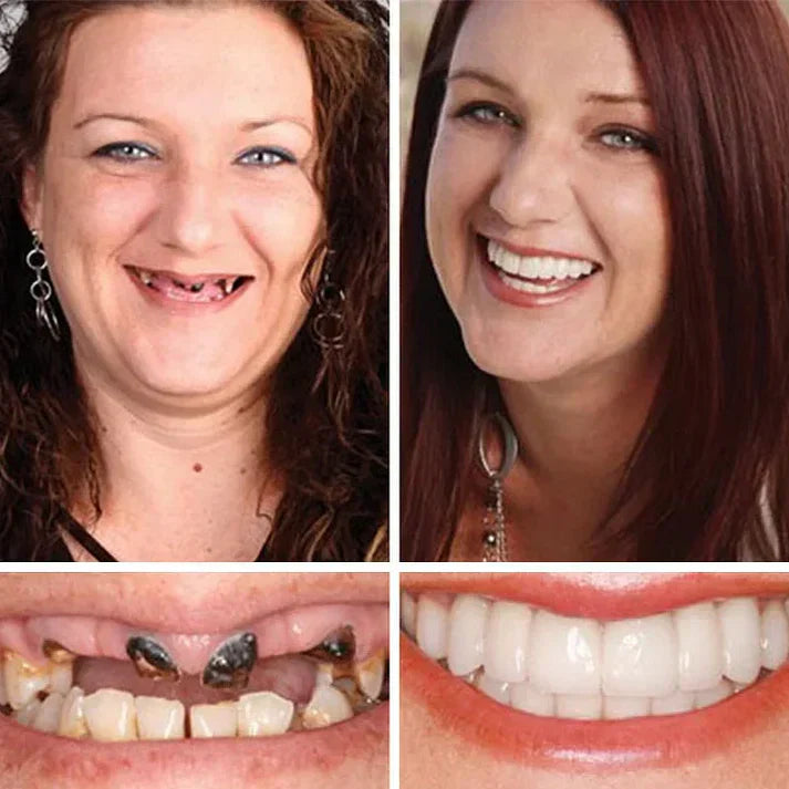 ⏰ KLENIMOR Natural Smile Upgrade
