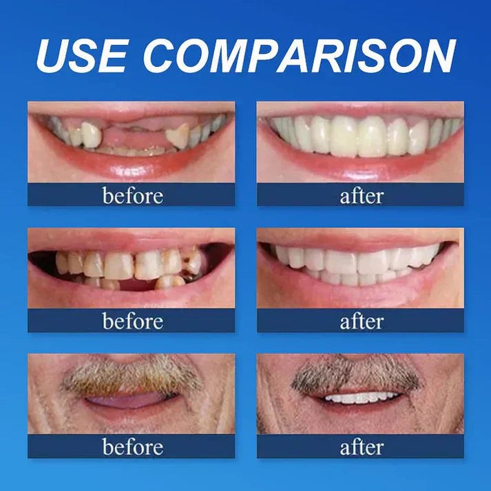 ⏰ KLENIMOR Natural Smile Upgrade