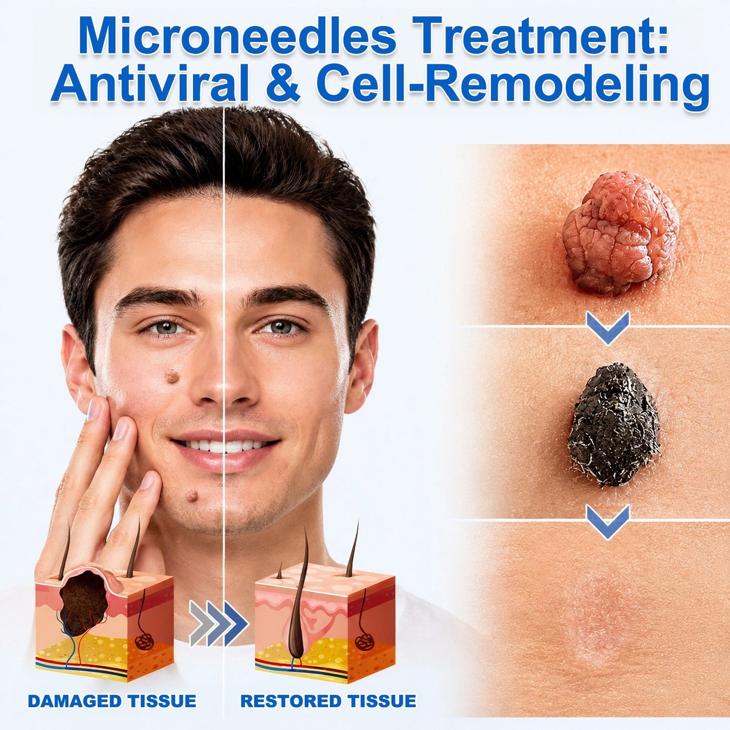 2-in-1 Microneedle & Hydrocolloid Patch 🌿 Invisible Face & Body Patches for Raised Moles, Acne, Flat Warts & Skin Tags - Helps Improve the Appearance of Wrinkles, Scars & Blemishes
