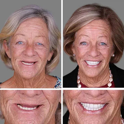 ⏰ KLENIMOR Natural Smile Upgrade
