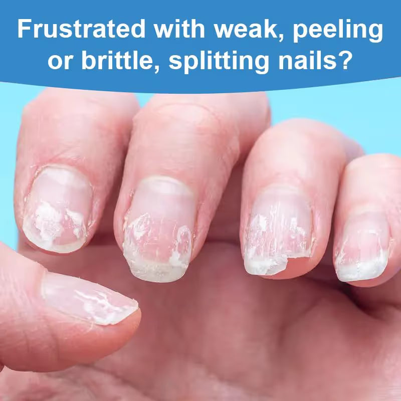💕3 Days Nail Care Formula