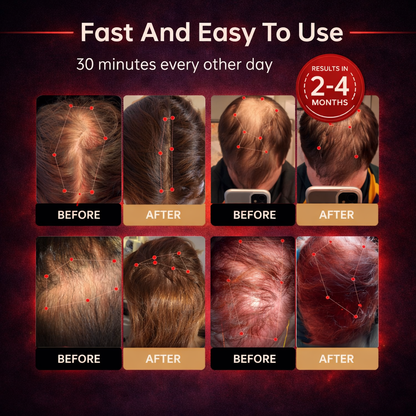 Regrowth Therapy Cap