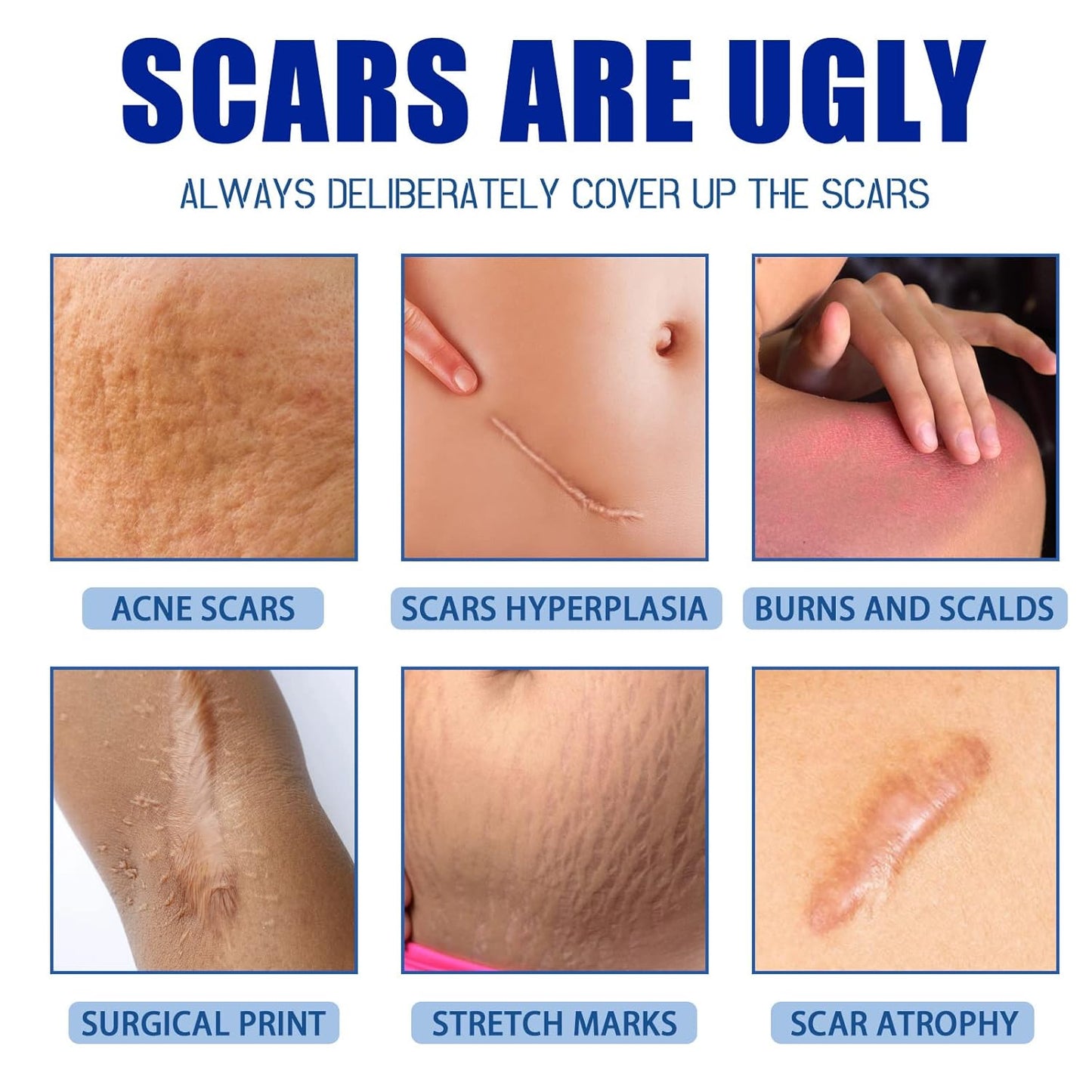 🩹Advanced Scar Repair Cream