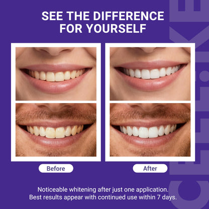 💜HOLIDAY FLASH SALE: ENAMEL-SAFE WHITENING STRIPS — BRIGHTEN YOUR SMILE, CHANGE A LIFE 💜