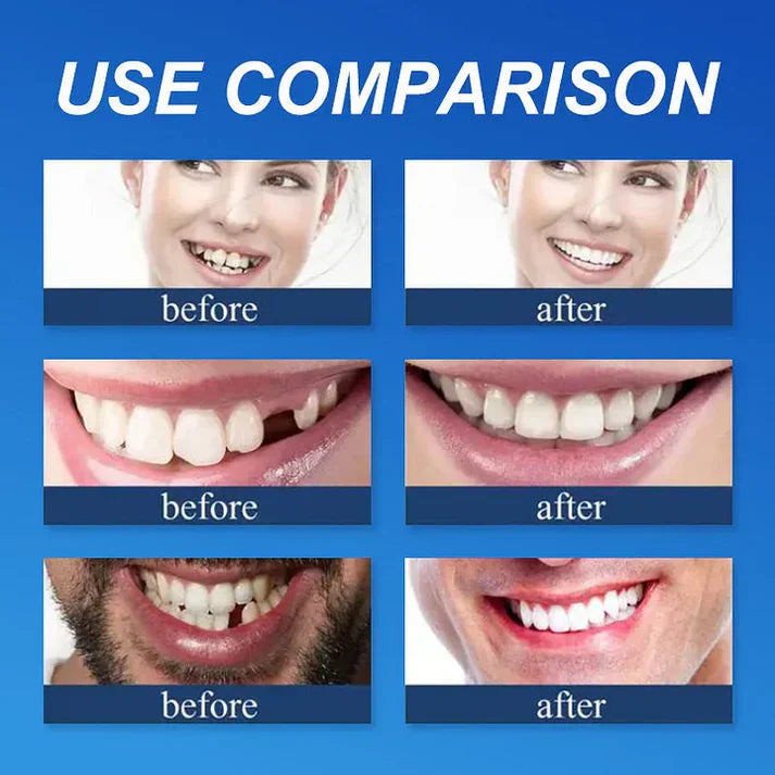 ⏰ KLENIMOR Natural Smile Upgrade